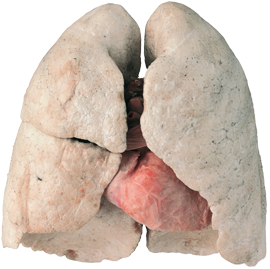 Die Lunge - Körperwelten