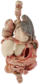Der Verdauungstrakt - Körperwelten