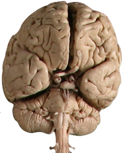 Das Nervensystem - Körperwelten